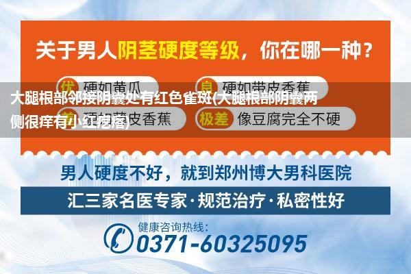 大腿根部邻接阴囊处有红色雀斑(大腿根部阴囊两侧很痒有小红疙瘩)